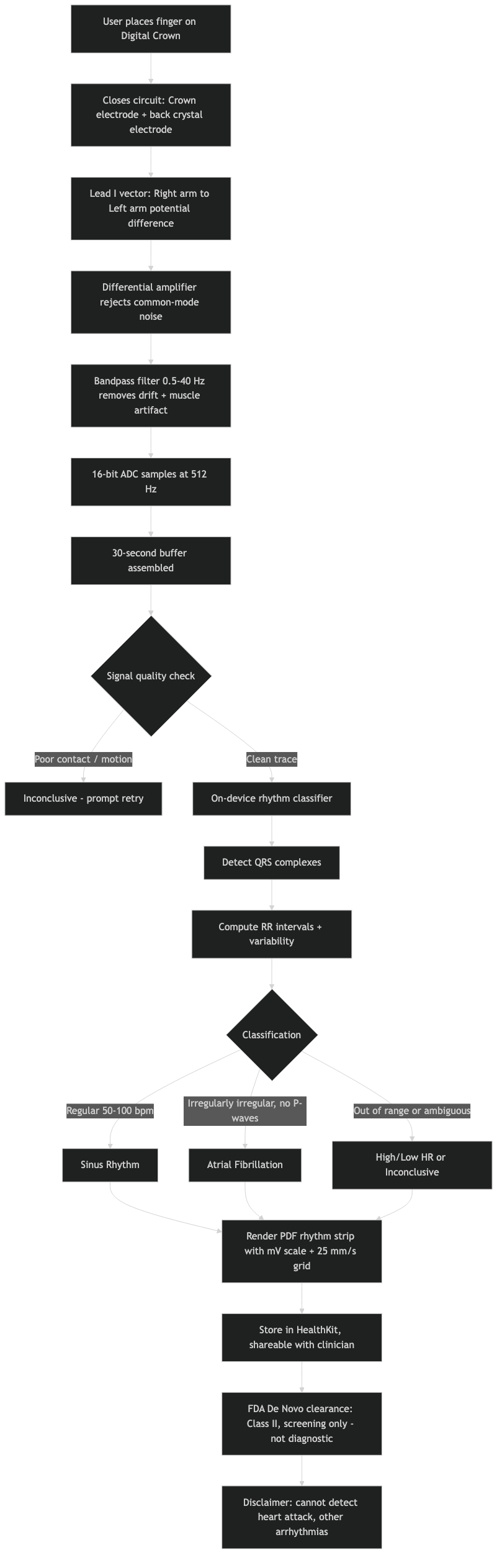 Architecture diagram for Inside Apple Watch ECG: how a single Lead I electrode becomes an FDA-cleared rhythm strip